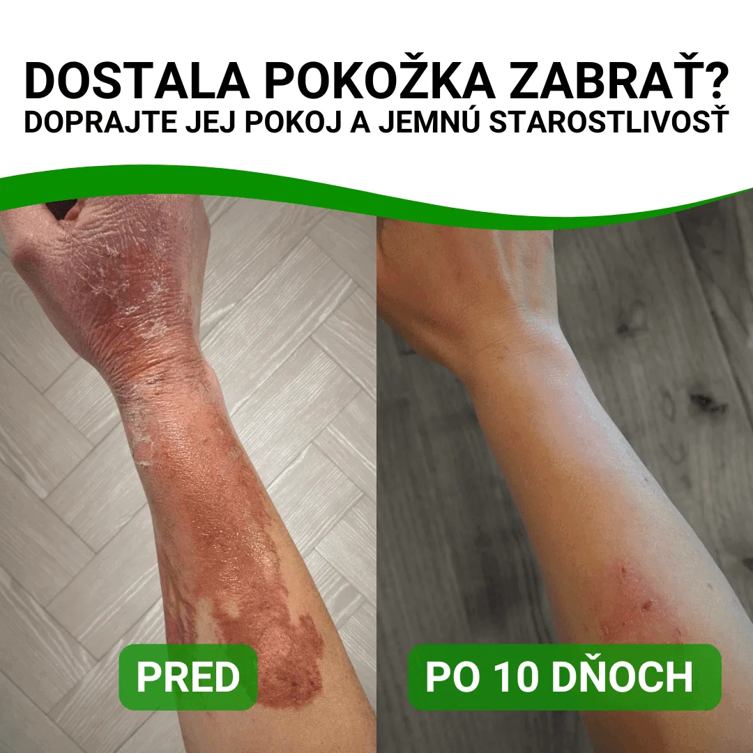 Hemp Ointment with Zinc by Konopný Táta (80 ml)